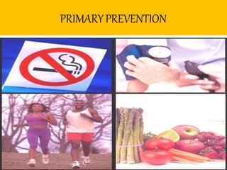 PRIMARYPREVENTION
 