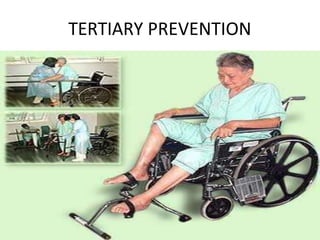 TERTIARY PREVENTION
 