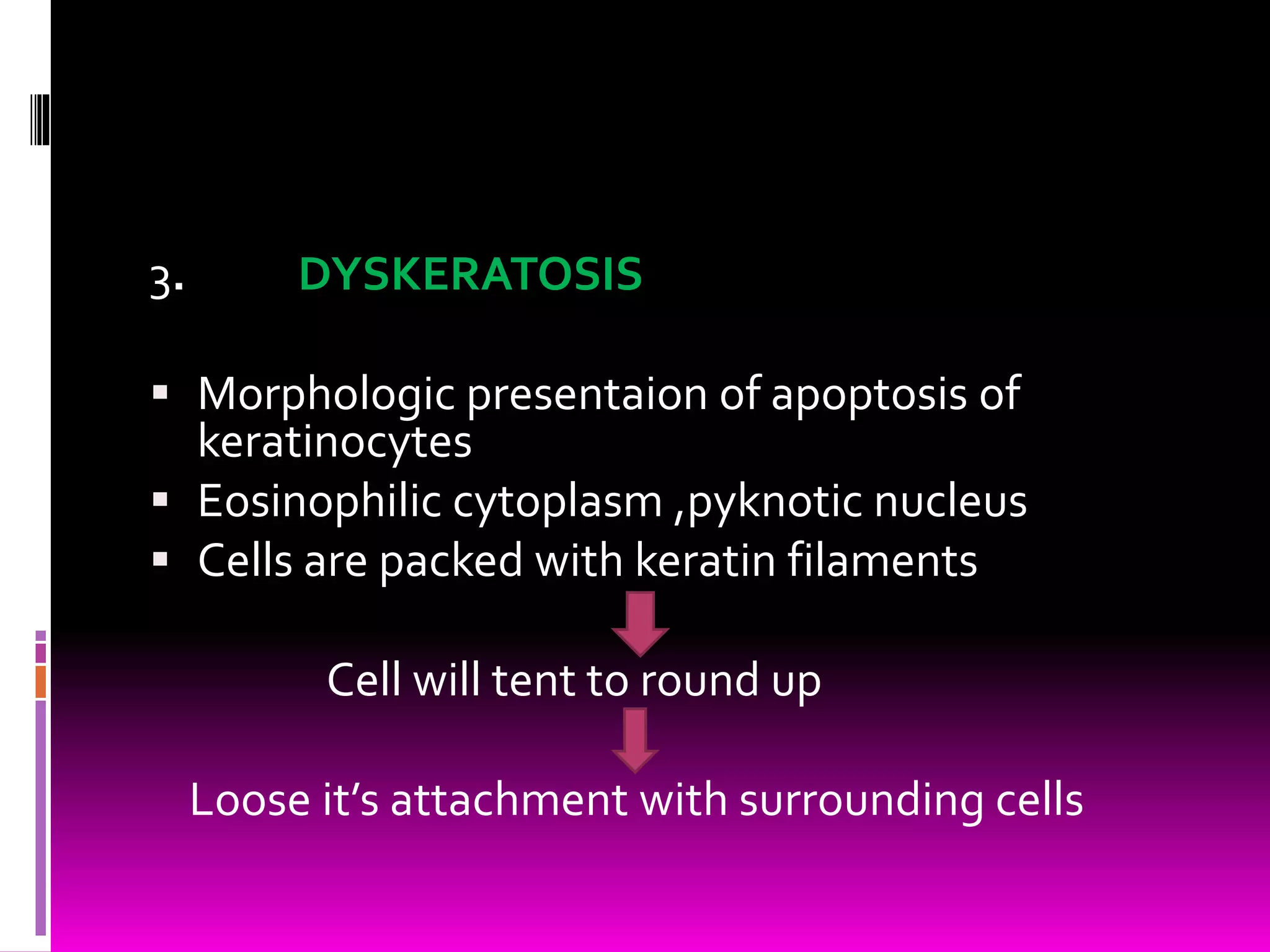 3. DYSKERATOSIS
 Morphologic presentaion of apoptosis of
keratinocytes
 Eosinophilic cytoplasm ,pyknotic nucleus
 Cells are packed with keratin filaments
Cell will tent to round up
Loose it’s attachment with surrounding cells
 