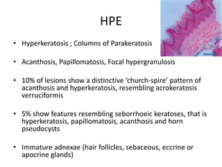 HPE
• Hyperkeratosis ; Columns of Parakeratosis
• Acanthosis, Papillomatosis, Focal hypergranulosis
• 10% of lesions show a distinctive ‘church-spire’ pattern of
acanthosis and hyperkeratosis, resembling acrokeratosis
verruciformis
• 5% show features resembling seborrhoeic keratoses, that is
hyperkeratosis, papillomatosis, acanthosis and horn
pseudocysts
• Immature adnexae (hair follicles, sebaceous, eccrine or
apocrine glands)
 