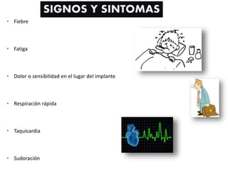 • Fiebre
• Fatiga
• Dolor o sensibilidad en el lugar del implante
• Respiración rápida
• Taquicardia
• Sudoración