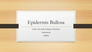 Epidermis Bullosa
Leslie Antonella Gallegos Garcilazo
Enfermería
148696
 