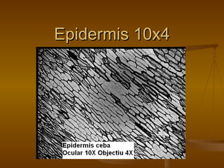 Epidermis 10x4 