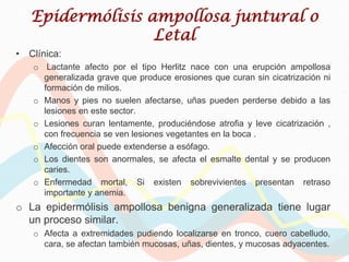 Epidermólisis ampollosa juntural o
                  Letal
• Clínica:
   o Lactante afecto por el tipo Herlitz nace con una erupción ampollosa
     generalizada grave que produce erosiones que curan sin cicatrización ni
     formación de milios.
   o Manos y pies no suelen afectarse, uñas pueden perderse debido a las
     lesiones en este sector.
   o Lesiones curan lentamente, produciéndose atrofia y leve cicatrización ,
     con frecuencia se ven lesiones vegetantes en la boca .
   o Afección oral puede extenderse a esófago.
   o Los dientes son anormales, se afecta el esmalte dental y se producen
     caries.
   o Enfermedad mortal, Si existen sobrevivientes presentan retraso
     importante y anemia.
o La epidermólisis ampollosa benigna generalizada tiene lugar
  un proceso similar.
   o Afecta a extremidades pudiendo localizarse en tronco, cuero cabelludo,
     cara, se afectan también mucosas, uñas, dientes, y mucosas adyacentes.
 