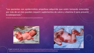 “Los pacientes con epidermólisis ampollosa adquirida que estén tomando esteroides
por más de un mes pueden requerir suplementos de calcio y vitamina D para prevenir
la osteoporosis.”
Tomado de: http://www.nlm.nih.gov/medlineplus/spanish/ency/article/001457.htm
Imagen tomada de: http://web.udl.es/usuaris/dermatol/Atlasweb/epidermolisis_ampollosa_cong/600/epidermolisis_amp10.jpg
- http://enfermedadclinica.com/wp-content/uploads/2013/08/Epidermolysis-bullosa.jpg
 