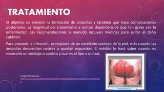 TRATAMIENTO
El objetivo es prevenir la formación de ampollas y también que haya complicaciones
posteriores. La magnitud del tratamiento a utilizar dependerá de que tan grave sea la
enfermedad. Las recomendaciones a menudo incluyen medidas para evitar el daño
cutáneo.
Para prevenir la infección, se requiere de un excelente cuidado de la piel, más cuando las
ampollas desarrollan costras o quedan expuestas. El médico le hará saber cuando es
necesario un vendaje o apósito y cual es el tipo a utilizar.
Imagen tomada de:
http://www.iqb.es/dermatologia/enfermedades/epidermolisis/epidermolisis14.jp
g
 