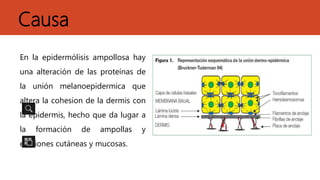 Causa
En la epidermólisis ampollosa hay
una alteración de las proteínas de
la unión melanoepidermica que
altera la cohesion de la dermis con
la epidermis, hecho que da lugar a
la formación de ampollas y
erusiones cutáneas y mucosas.
 