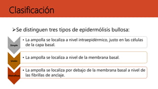 Clasificación
Se distinguen tres tipos de epidermólisis bullosa:
Simple
• La ampolla se localiza a nivel intraepidérmico, justo en las células
de la capa basal.
Unión
• La ampolla se localiza a nivel de la membrana basal.
Distroficas
• La ampolla se localiza por debajo de la membrana basal a nivel de
las fibrillas de anclaje.
 