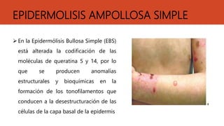 EPIDERMOLISIS AMPOLLOSA SIMPLE
En la Epidermólisis Bullosa Simple (EBS)
está alterada la codificación de las
moléculas de queratina 5 y 14, por lo
que se producen anomalías
estructurales y bioquímicas en la
formación de los tonofilamentos que
conducen a la desestructuración de las
células de la capa basal de la epidermis
 