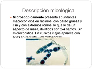 Descripción micológica
 Microscópicamente presenta abundantes
macroconidios en racimos, con pared gruesa y
lisa y con extremos romos, lo que le da un
aspecto de maza, divididos con 2-4 septos. Sin
microconidios. En cultivos viejos aparece con
hifas en raqueta y clamidosporas.
 