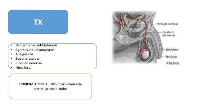 Epididimitis Orquitis Y Orquiepididimitis Clinica De Urologia Y