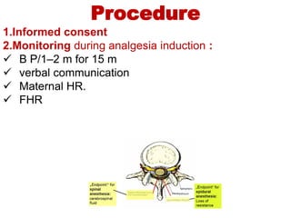 Procedure
1.Informed consent
2.Monitoring during analgesia induction :
 B P/1–2 m for 15 m
 verbal communication
 Mater...