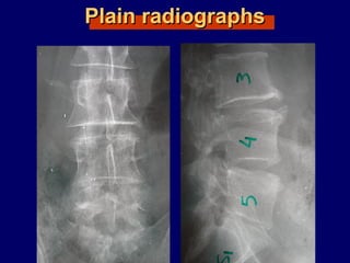 Plain radiographsPlain radiographs
 