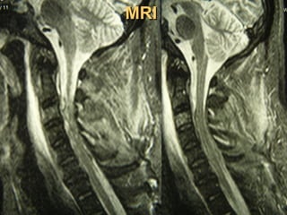 MRIMRI
 