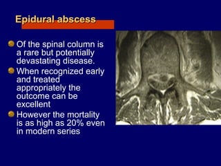 Epidural abscessEpidural abscess
Of the spinal column is
a rare but potentially
devastating disease.
When recognized early
and treated
appropriately the
outcome can be
excellent
However the mortality
is as high as 20% even
in modern series
 