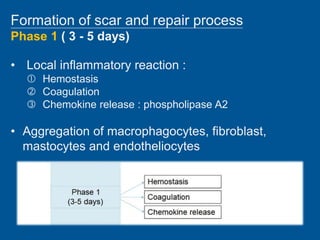 Scar Process epidural adhesion prevention.pptx
