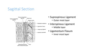 Sagittal Section
• Supraspinous Ligament
• Outer most layer
• Interspinous Ligament
• Middle layer
• Ligamentum Flavum
• Inner most layer
 