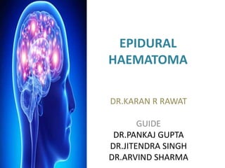 EPIDURAL
HAEMATOMA
DR.KARAN R RAWAT
GUIDE
DR.PANKAJ GUPTA
DR.JITENDRA SINGH
DR.ARVIND SHARMA
 