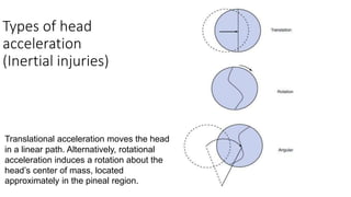 Types of head
acceleration
(Inertial injuries)
Translational acceleration moves the head
in a linear path. Alternatively, rotational
acceleration induces a rotation about the
head’s center of mass, located
approximately in the pineal region.
 