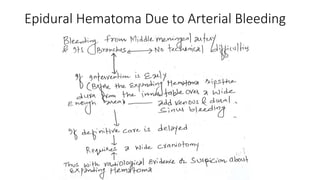 Epidural Hematoma Due to Arterial Bleeding
 
