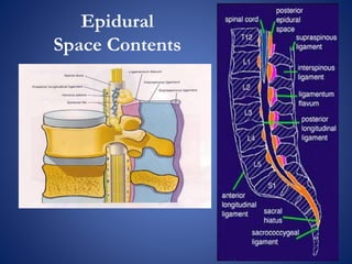 Epidural injections | PPTX