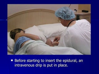 Before starting to insert the epidural, an intravenous drip is put in place. 