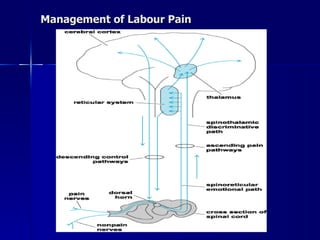 Management of Labour Pain 