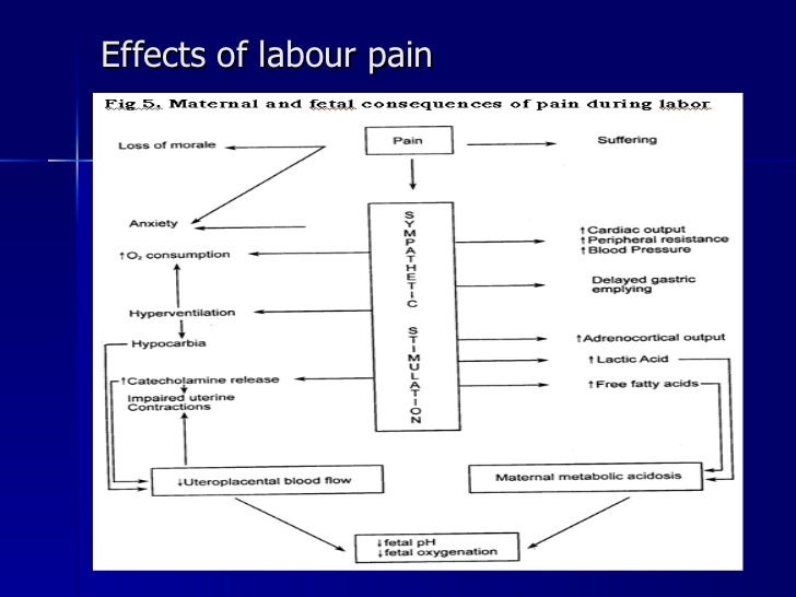 Epidural labour pain relief