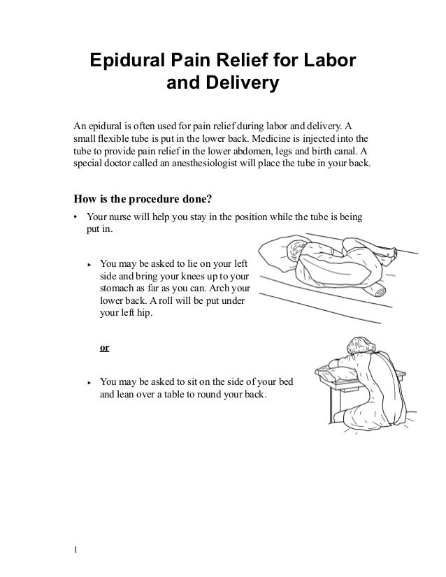 Epidural pain relief for labor and delivery dich thuat phien dich cnn