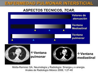 ASPECTOS TECNICOS,  TCAR. Ventana  mediastinal Ventana pulmonar ENFERMEDAD PULMONAR INTERSTICIAL Ventana Mediastinal Ventana  pulmonar Valores de atenuación Motta-Ramirez GA. Neumología y Radiología: Sinergia y o anergia.  Anales de Radiología México 2008; 1:27-40 