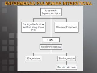 ENFERMEDAD PULMONAR INTERSTICIAL TCAR 