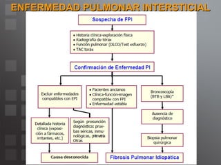 ENFERMEDAD PULMONAR INTERSTICIAL 