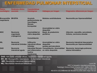 ENFERMEDAD PULMONAR INTERSTICIAL DAD:  NIA Daño alveolar difuso, neumonía intersticial aguda,  BR- EII:  Bronquiolitis respiratoria – Enfermedad intersticial, NID:  Neumonía intersticial descamativa,  NIL:  Neumonía intersticial linfocítica. Lynch DA .  HRCT of idiopathic interstitial pneumonias.  Radiologic Clinics of North America 2001; 39(6):1153-1170 RadioGraphics 2007; 27:595–615 REVISTA COLOMBIANA DE REUMATOLOGÍA 2007;14(2):115-127 Patrón morfológico Síndrome clínico asociado Características histológicas Hallazgos por Imagen Diagnostico diferencial por Imagen Bronquiolitis respiratoria BR-EPIA Acumulo peribronchiolar de macrófagos, fibrosis bronquiolar Nódulos centrilobulares Neumonitis por hipersensibilidad  Anormalidad en vidrio despulido NOC Neumonía organizada criptogenica Anormalidad en vidrio despulido Basal, de predominio periférico Infección, vasculitis, sarcoidosis, linfoma, carcinoma alveolar Consolidación NIL Neumonía intersticial linfoidea  Infiltración intersticial difusa linfoidea  Anormalidad en vidrio despulido quistes perivasculares  Neumonía intersticial descamativa   Neumonitis por hipersensibilidad  DAD Neumonía intersticial aguda Interstitial fibrosis and inflammation, hyaline membranes Consolidación,  Anormalidad en vidrio despulido Neumonía, hemorragia pulmonar, edema hidrostático 