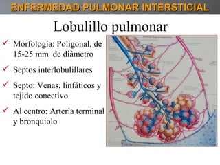 ENFERMEDAD PULMONAR INTERSTICIAL Lobulillo pulmonar  Morfología: Poligonal, de 15-25 mm  de diámetro Septos interlobulillares Septo: Venas, linfáticos y tejido conectivo Al centro: Arteria terminal y bronquiolo 
