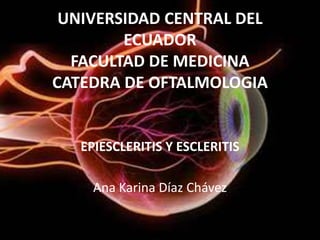 UNIVERSIDAD CENTRAL DEL
ECUADOR
FACULTAD DE MEDICINA
CATEDRA DE OFTALMOLOGIA
EPIESCLERITIS Y ESCLERITIS
Ana Karina Díaz Chávez
 