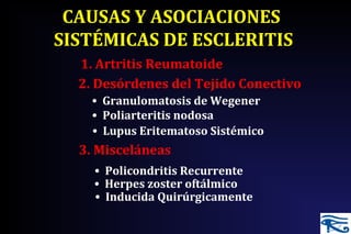 CAUSAS Y ASOCIACIONES
SISTÉMICAS DE ESCLERITIS
1. Artritis Reumatoide
• Granulomatosis de Wegener
• Poliarteritis nodosa
• Lupus Eritematoso Sistémico
2. Desórdenes del Tejido Conectivo
3. Misceláneas
• Policondritis Recurrente
• Herpes zoster oftálmico
• Inducida Quirúrgicamente
 