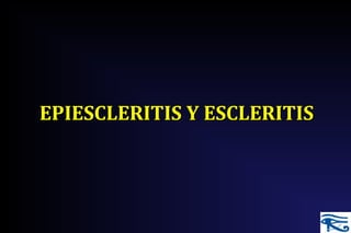EPIESCLERITIS Y ESCLERITISEPIESCLERITIS Y ESCLERITIS
 