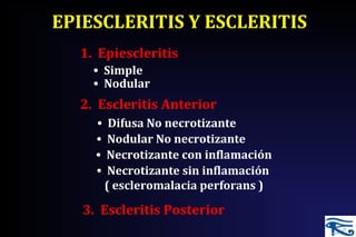 EPIESCLERITIS Y ESCLERITIS
1. Epiescleritis
• Simple
• Nodular
2. Escleritis Anterior
• Difusa No necrotizante
• Nodular No necrotizante
• Necrotizante con inflamación
• Necrotizante sin inflamación
( escleromalacia perforans )
3. Escleritis Posterior
 
