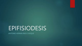 EPIFISIODESIS
ANTONIO ADRIAN RIOS CHOQUE
 