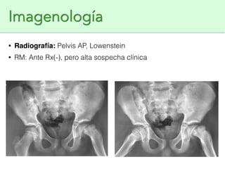 Lowenstein Rx Epifisiolisis | PDF