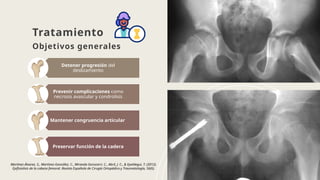 Epifisiolistesis de la Cabeza Femoral en Adolescentes | PPTX