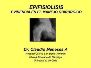 EPIFISIOLISIS
EVIDENCIA EN EL MANEJO QUIRÚRGICO




     Dr. Claudio Meneses A
      Hospital Clínico San Borja- Arriarán
        Clínica Alemana de Santiago
             Universidad de Chile
 