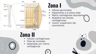 Zona I
 Células germinales
 Adyacentes a la placa ósea
 Matriz cartilaginosa abundante
 Abastece las células
cartilaginosas
 Lesión: suspensión del
crecimiento
Zona II
 Células cartilaginosas
 Pilas de monedas
 Separadas por matriz
cartilaginosa
 