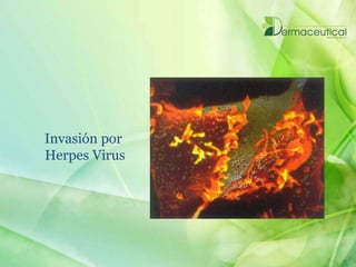 Invasión por
Herpes Virus
 