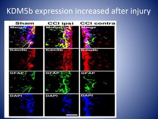KDM5b expression increased after injury
 