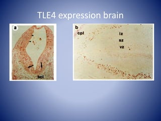 TLE4 expression brain
 