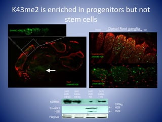 KDM5b
2meK43
H2B
3Xflag
H2B
H2B
3XFl
H2B
mESC
3XFl
K43A-
mESC
3XFl
H2B
NS
3XFl
K43A-
NS
Flag M2
K43me2 is enriched in progenitors but not
stem cells
Doublecortin
2meK43 H2B
Nose tail
Phospho-H3
2meK43 H2B
TUJ1
2meK43 H2B
2meK43 H2B
Dorsal Root ganglia
 