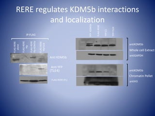 Anti YFP
(TLE4)
FLAG RERE (FL)
FLAG-RERE
Yfp
FLAG-RERE
YfpKDM5b
FLAG-RERE
YfpTLE4
FLAG-RERE
alone
Anti KDM5b
IP:FLAG
RERE regulates KDM5b interactions
and localization
FLAG-RERE
YFP-KDM5b
YFP-TLE4
YFPC1
Whole cell Extract
Chromatin Pellet
antiKDM5b
antiKDM5b
antiGAPDH
antiH3
 