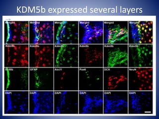 KDM5b expressed several layers
 