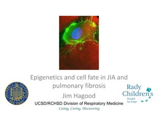 Epigenetics and cell fate in JIA and
pulmonary fibrosis
Jim Hagood
UCSD/RCHSD Division of Respiratory Medicine
Caring, Curing, Discovering
 